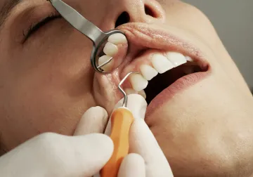 Revisión de los dientes con un espejo dental